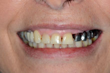 Probamos la estructura de metal