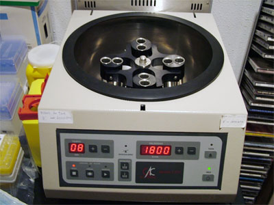 Plasma rico en plaquetas